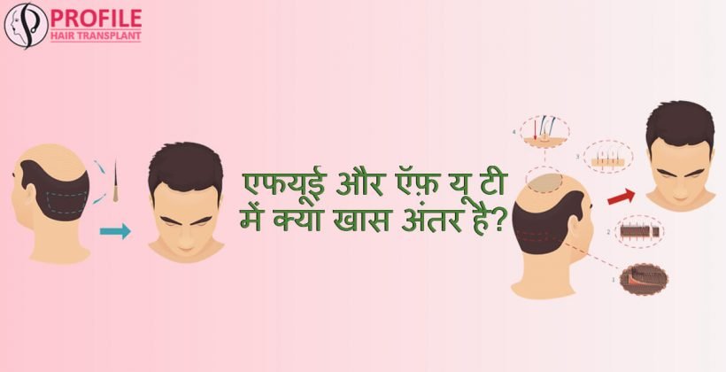 ऍफ़यूई  और ऍफ़यूटी क्या खास अंतर है ?