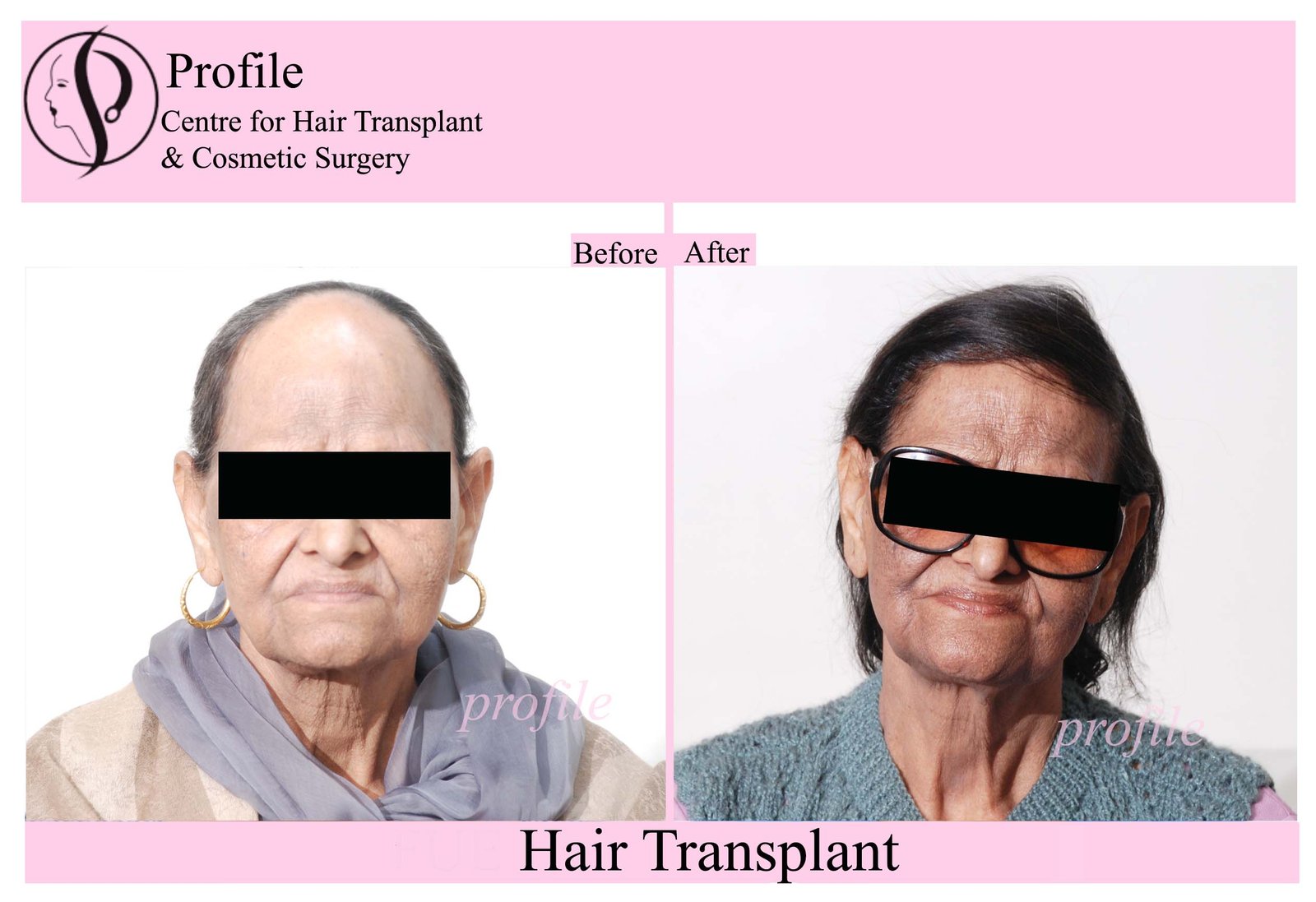femaleht-3
