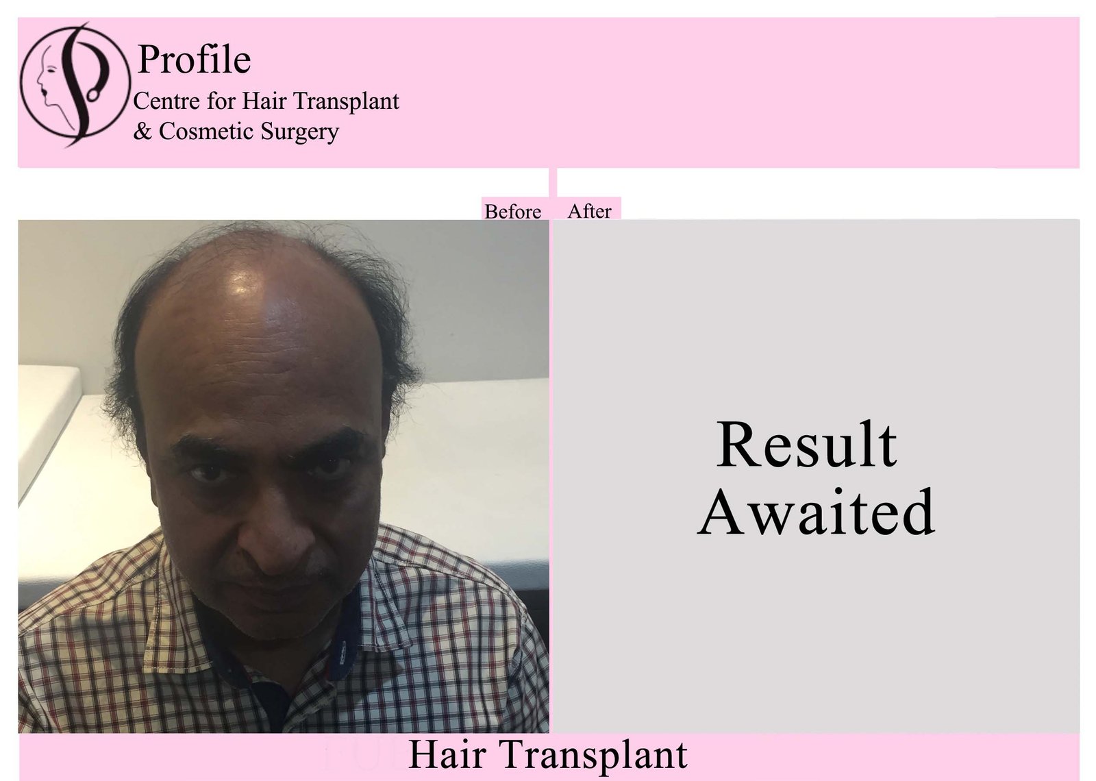 Dr. Barnala
