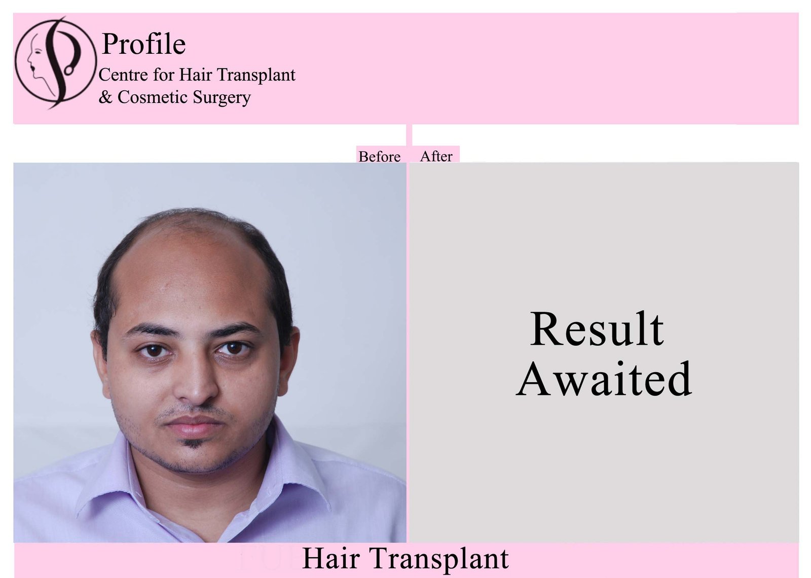 Dr. Devendra K Gupta