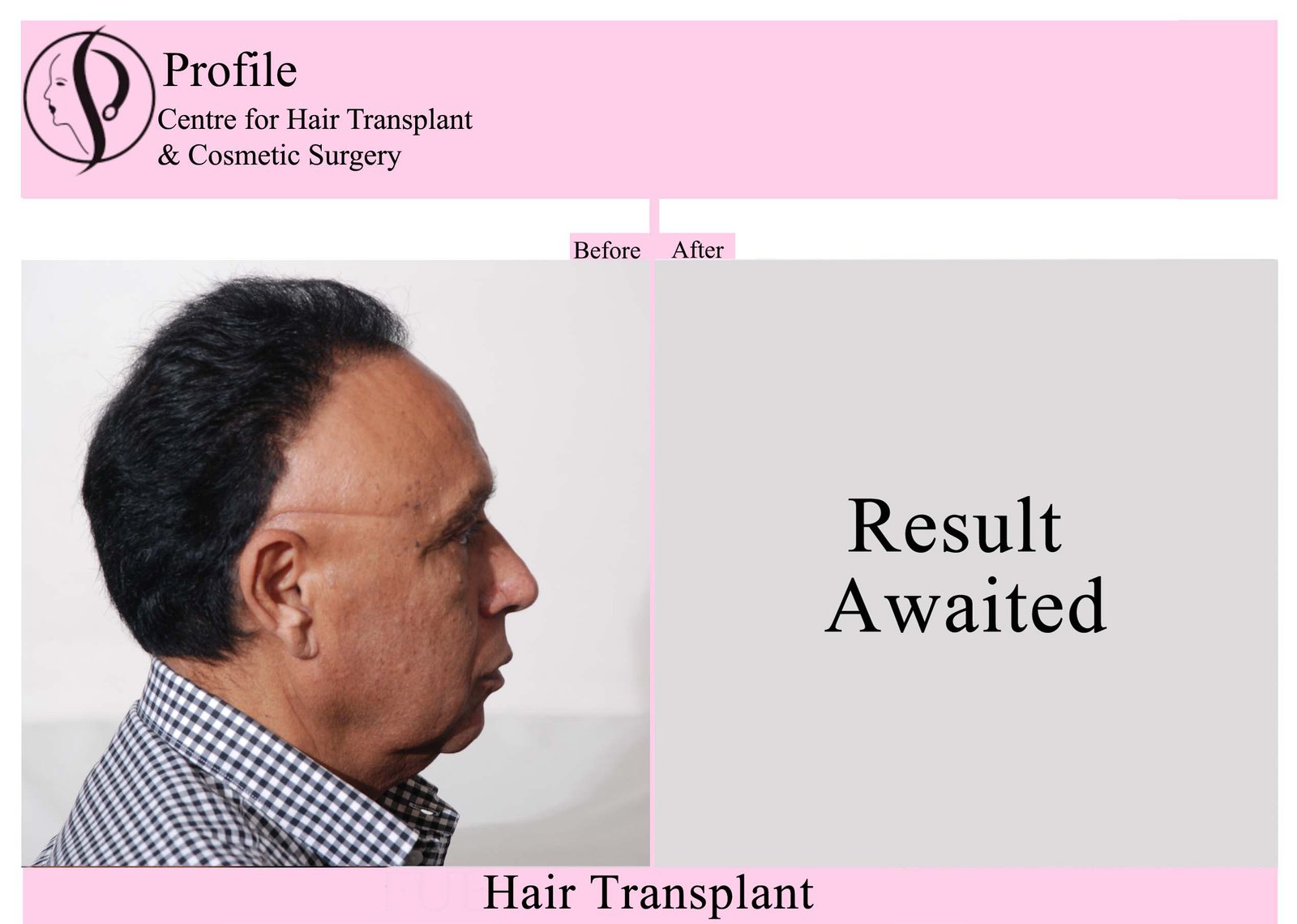 Dr. Palwinder Singh