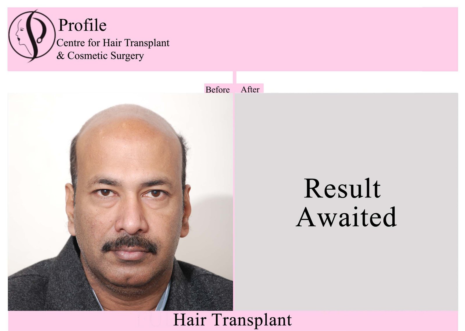 Dr. Parshotam Jindal