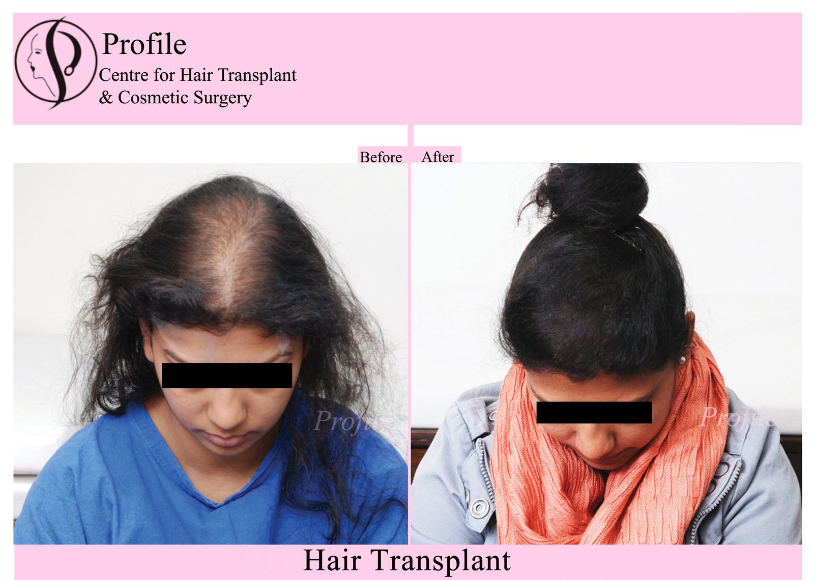 Female Hair