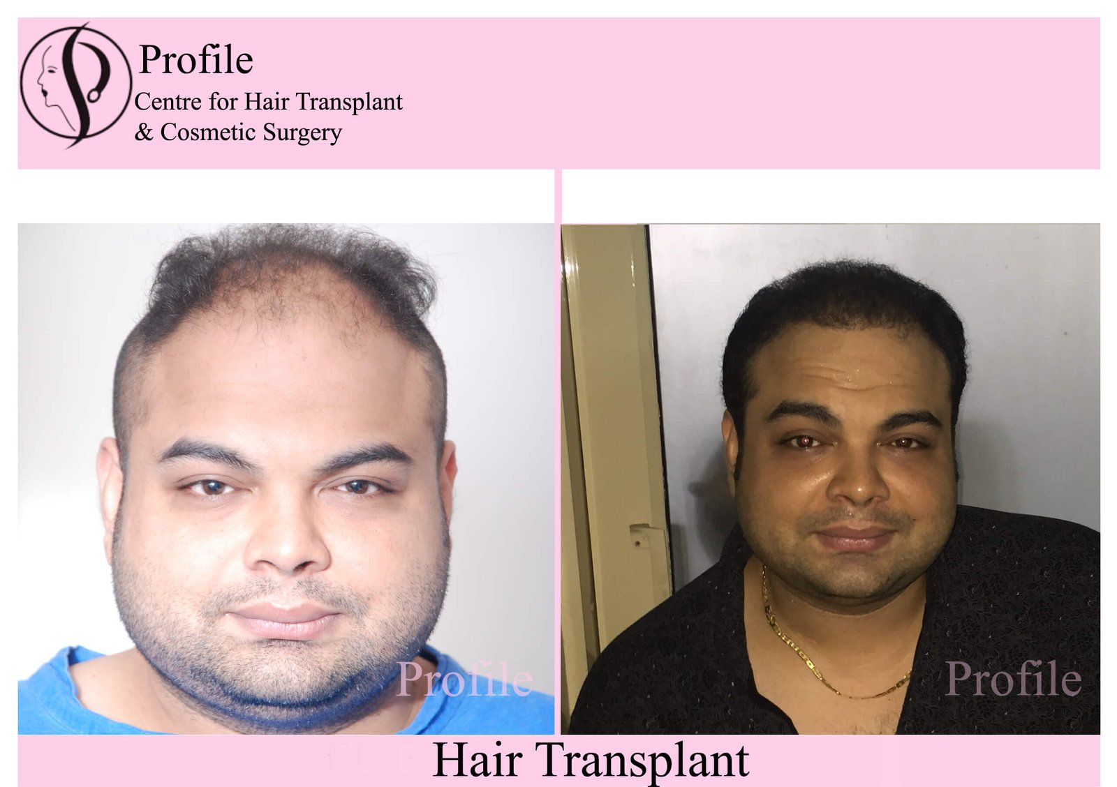 Dr Amit