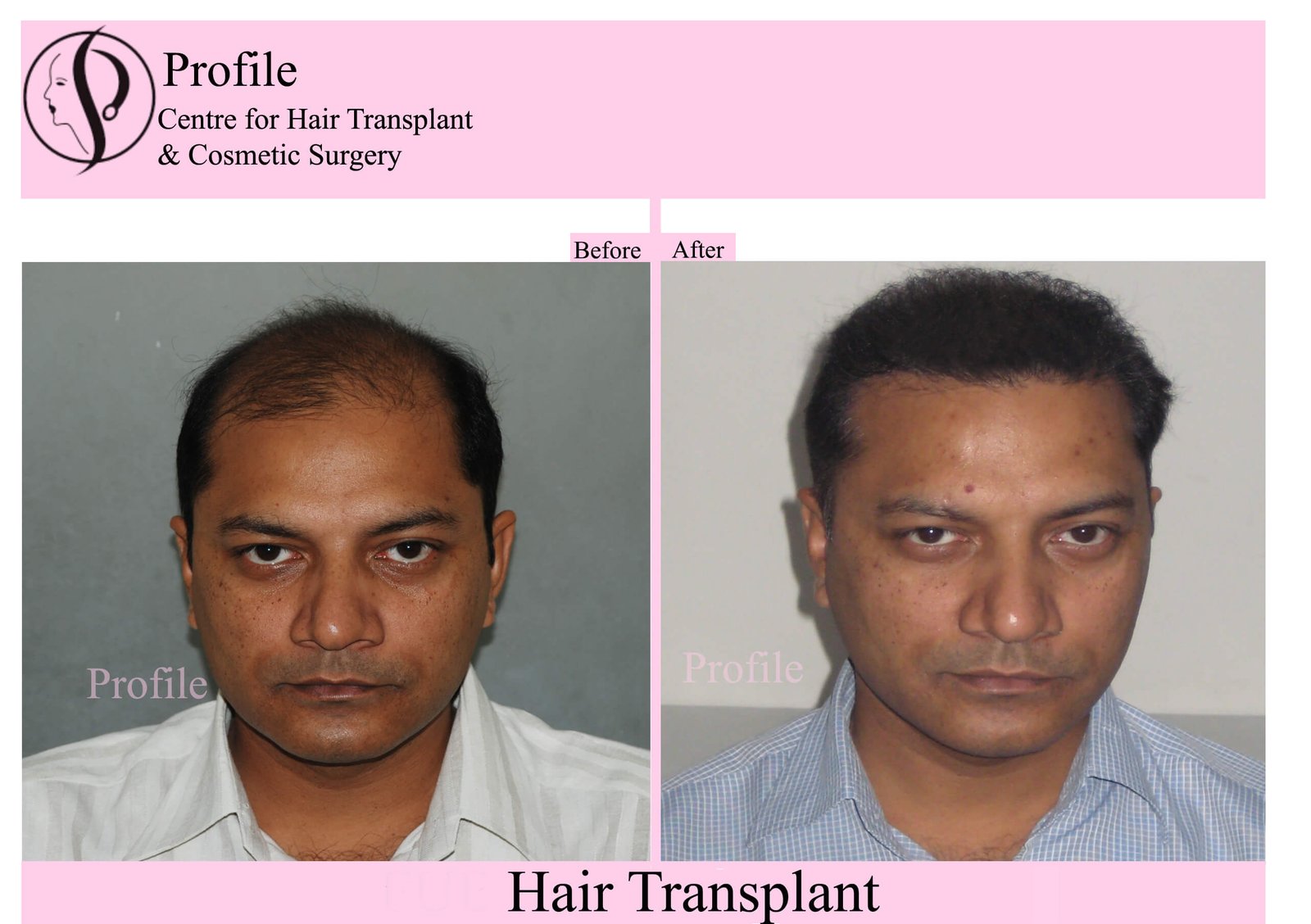 Dr Ashish