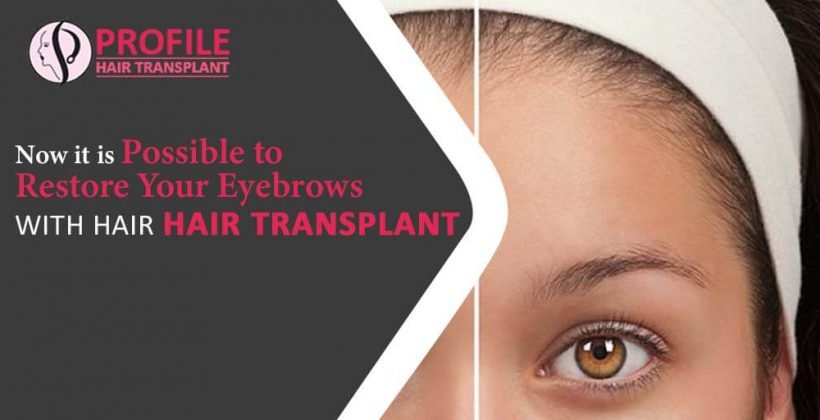 Now it is Possible to Restore your Eyebrows with Hair Transplant