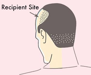 RECIPIENT SITE CREATION