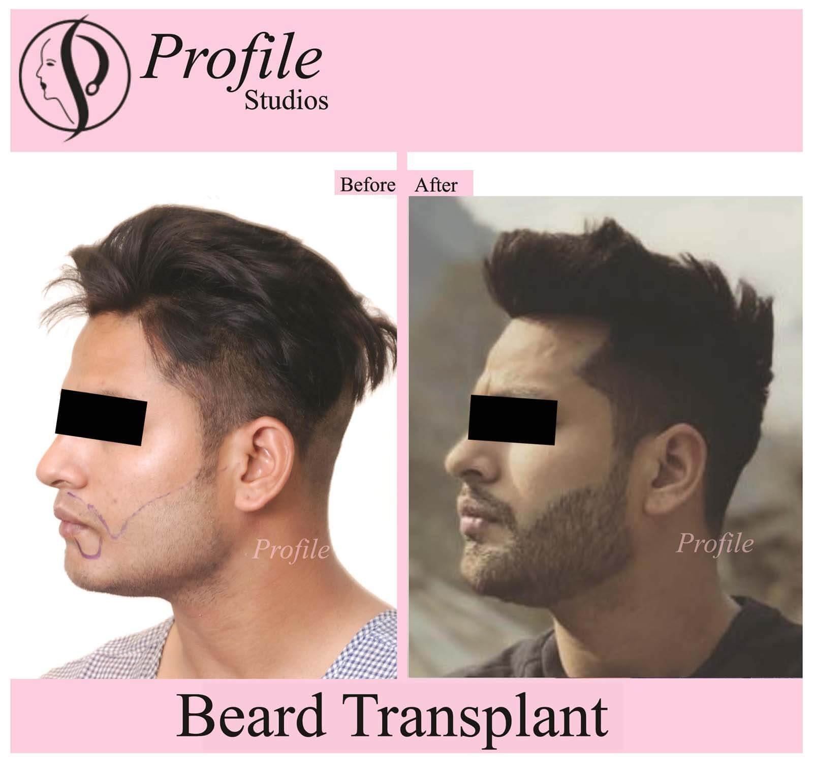 gurpreet beard11 (1)
