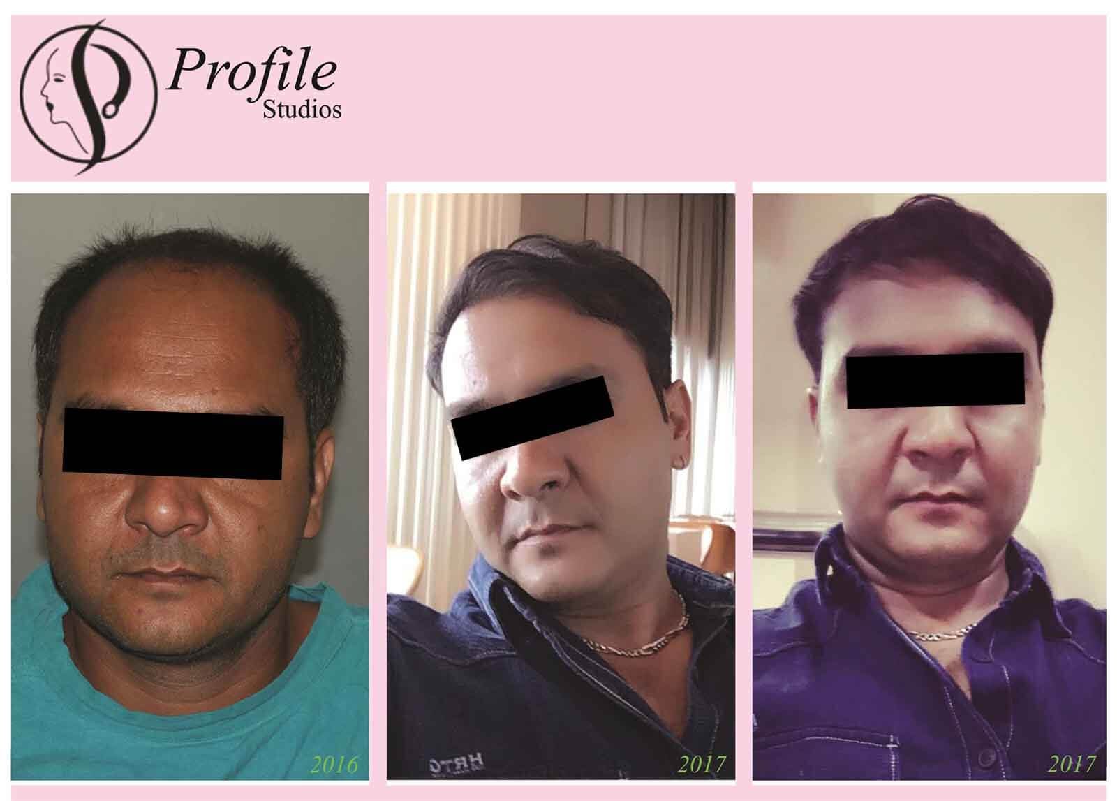 riteshkanabar