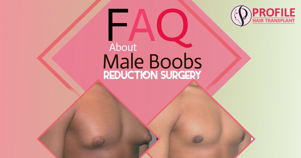 Faq About Male Boobs Reduction Surgery