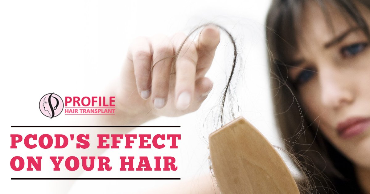 PCOD’s Effect On Your Hair