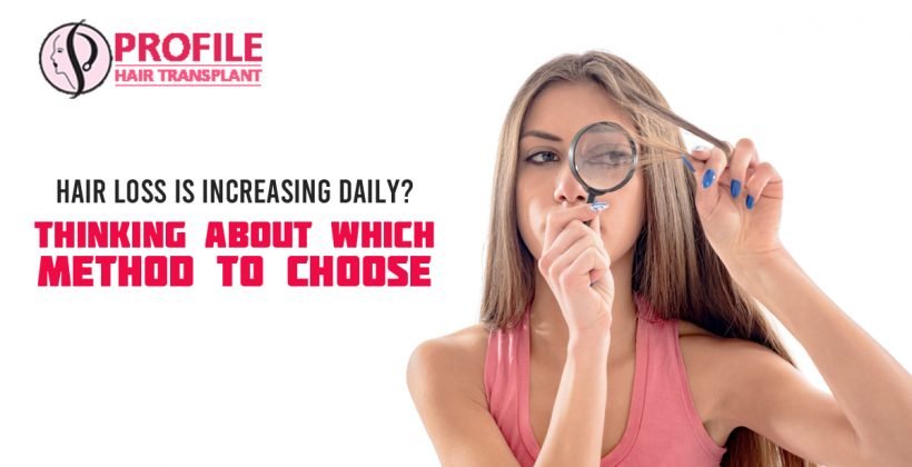 Hair Loss is Increasing Daily? Thinking About Which Method To Choose