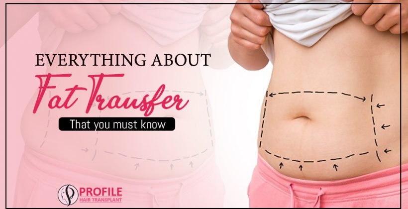 Everything About Fat Transfer That You must Know
