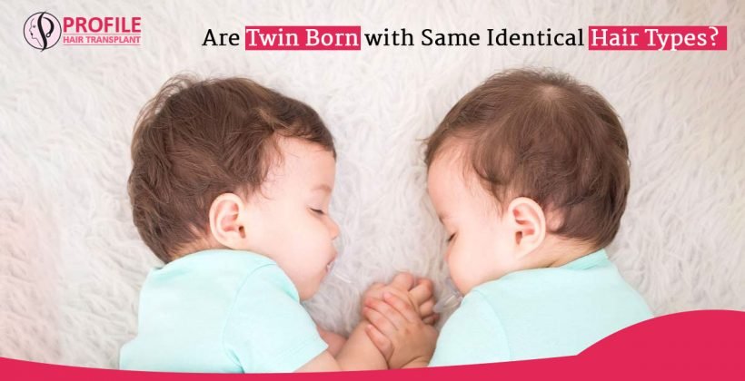 Are Twin Born with the same hair types?