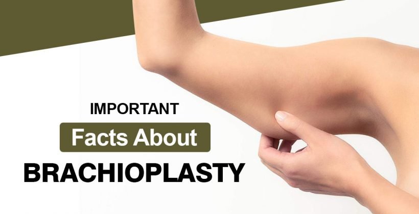 Important Facts About Brachioplasty