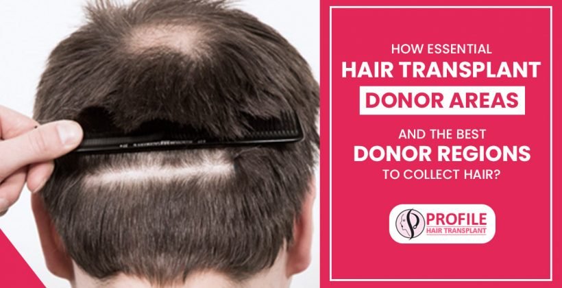 How essential Hair Transplant Donor Areas and the best donor regions to collect hair?