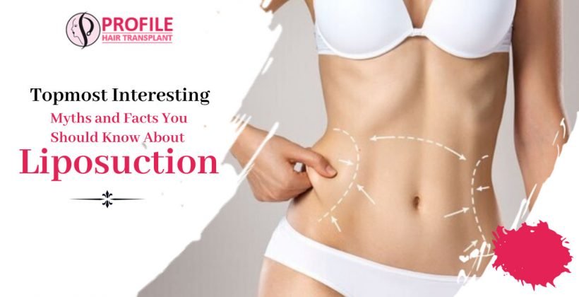 Topmost interesting myths and facts you should know about Liposuction