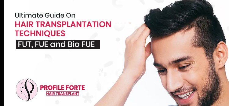 Ultimate Guide on Hair transplantation techniques – FUT, FUE and Bio FUE