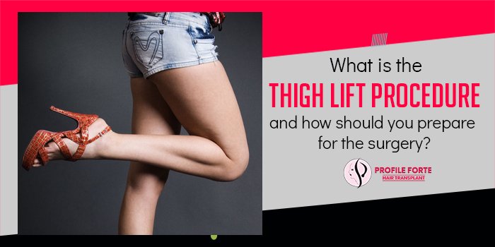What is the thigh lift procedure and how should you prepare for the surgery?