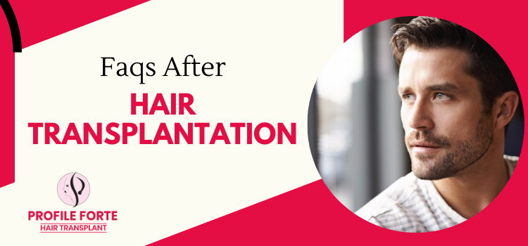 Profile Forte answers the common questions of the hair transplant patients