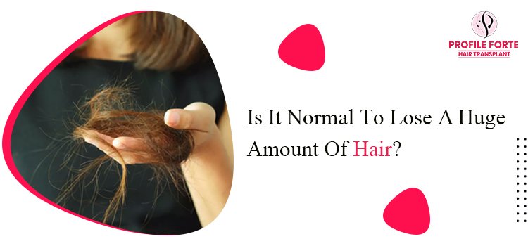 Some Of The Causes Of Losing Huge Amount Of Hair On A Daily Basis