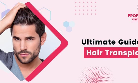Is it possible to have a hair transplant with another person’s hair?