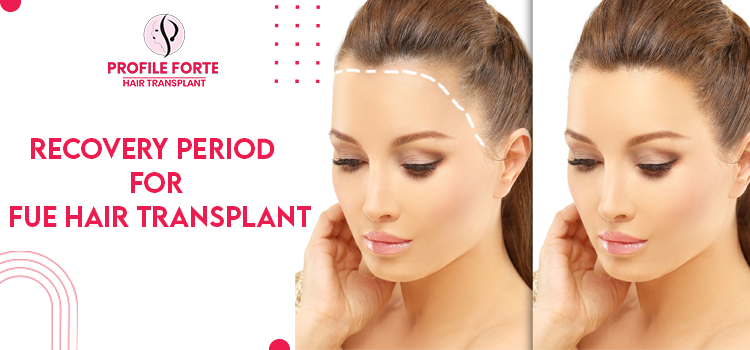 How much is the downtime after an FUE Hair Transplant treatment?